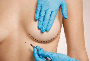 breast augmentation in Durgapur