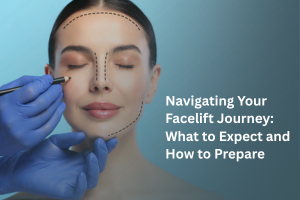 Navigating Your Facelift Journey: What to Expect and How to Prepare
