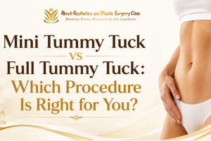 Mini Tummy Tuck vs Full Tummy Tuck: Which Procedure Is Right for You?