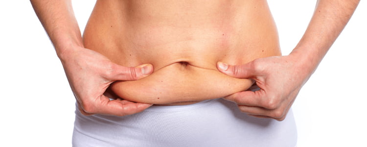 Liposuction or Tummy Tuck